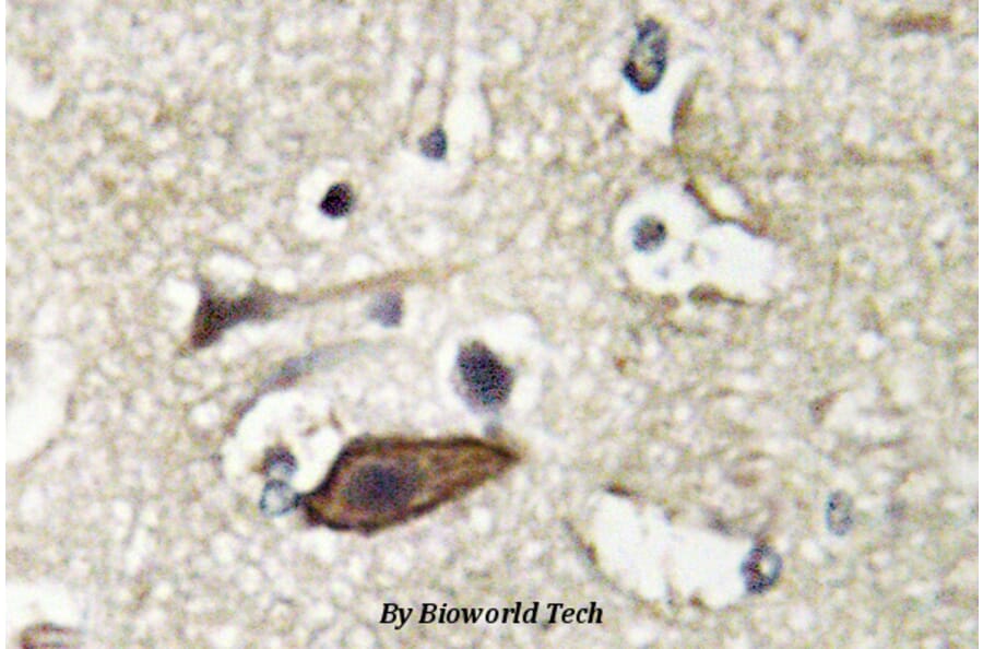Anti-Tsg 101 (E303) Antibody from Bioworld Technology (BS2347) - Antibodies.com