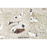Anti-Tsg 101 (E303) Antibody from Bioworld Technology (BS2347) - Antibodies.com