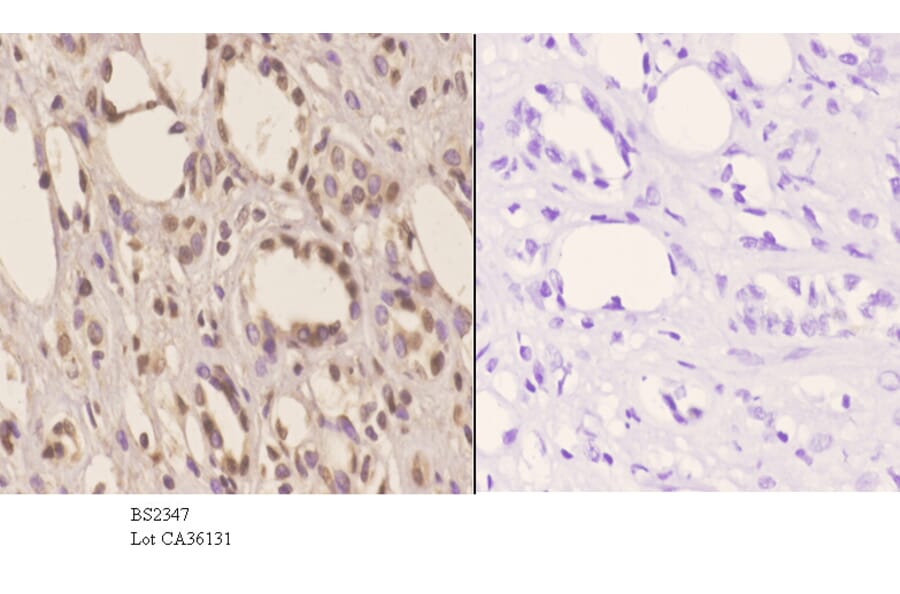 Anti-Tsg 101 (E303) Antibody from Bioworld Technology (BS2347) - Antibodies.com