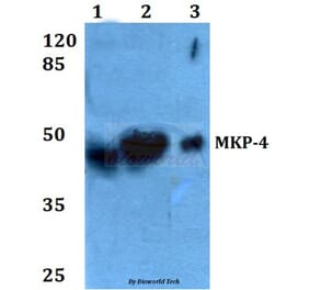 Anti-MKP-4 (A174) Antibody from Bioworld Technology (BS2348) - Antibodies.com