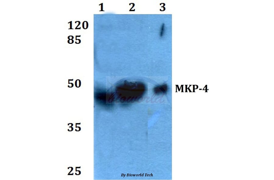 Anti-MKP-4 (A174) Antibody from Bioworld Technology (BS2348) - Antibodies.com