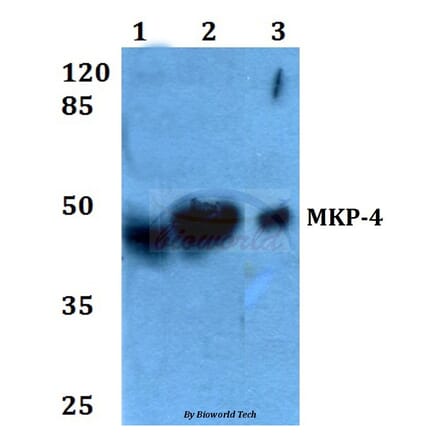 Anti-MKP-4 (A174) Antibody from Bioworld Technology (BS2348) - Antibodies.com