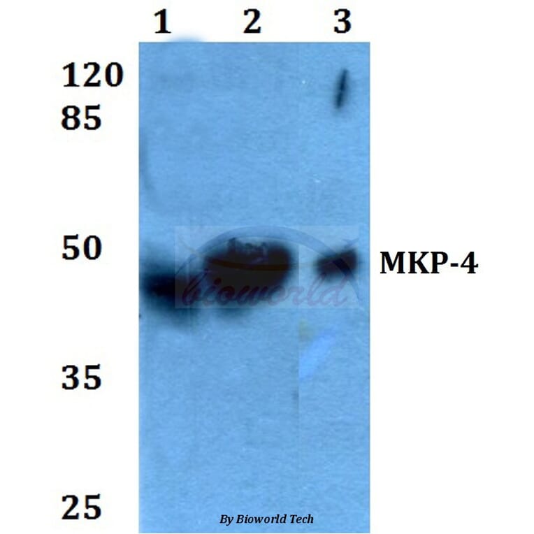 Anti-MKP-4 (A174) Antibody from Bioworld Technology (BS2348) - Antibodies.com