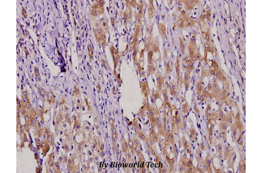 Anti-MKP-4 (A174) Antibody from Bioworld Technology (BS2348) - Antibodies.com