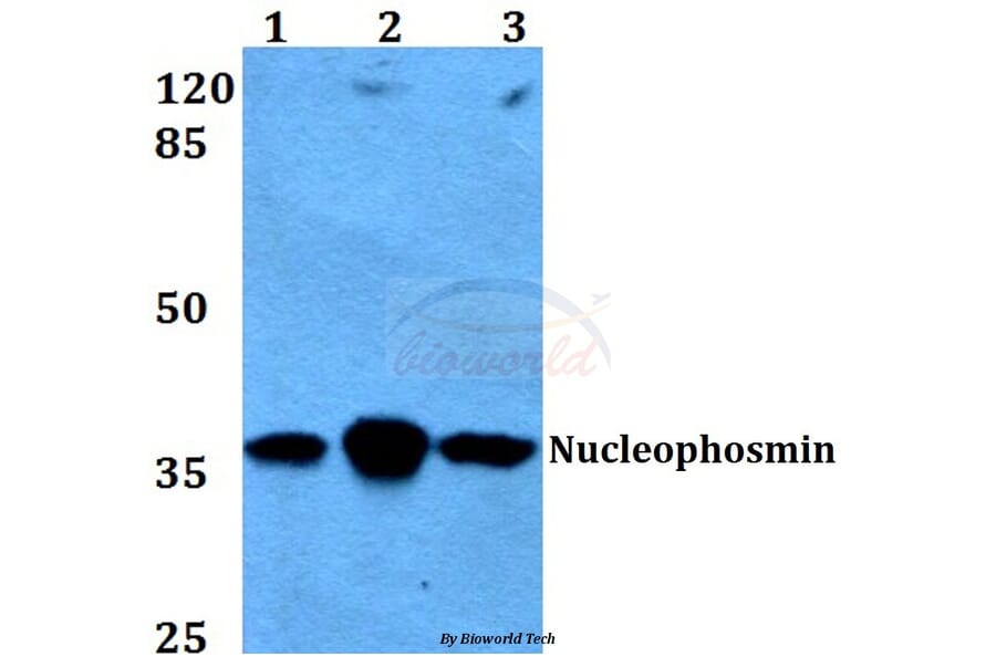 Anti-Nucleophosmin (E22) Antibody from Bioworld Technology (BS2353) - Antibodies.com