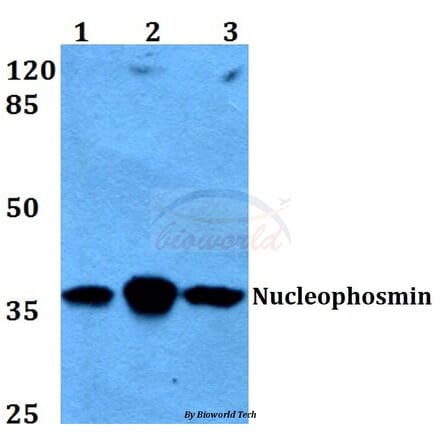 Anti-Nucleophosmin (E22) Antibody from Bioworld Technology (BS2353) - Antibodies.com