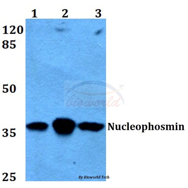 Anti-Nucleophosmin (E22) Antibody from Bioworld Technology (BS2353) - Antibodies.com