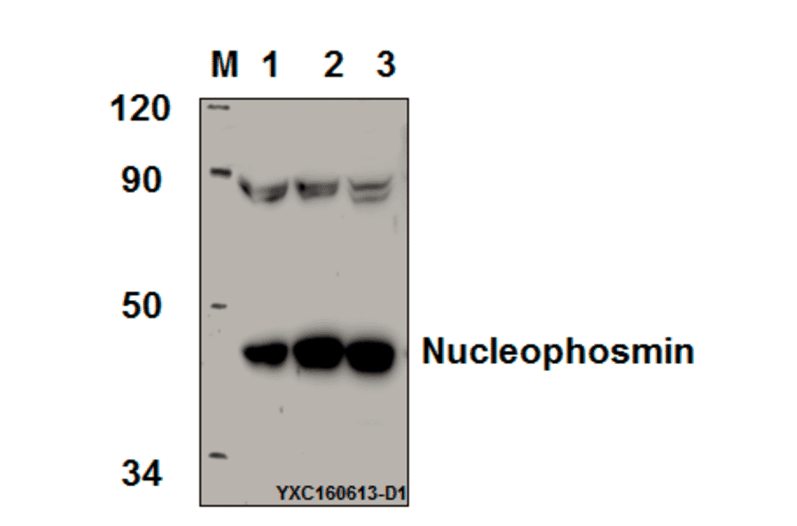 Anti-Nucleophosmin (E22) Antibody from Bioworld Technology (BS2353) - Antibodies.com