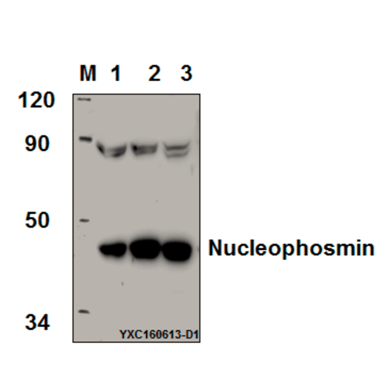 Anti-Nucleophosmin (E22) Antibody from Bioworld Technology (BS2353) - Antibodies.com
