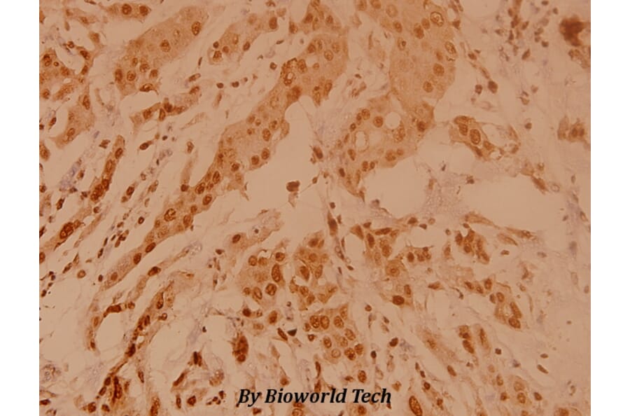 Anti-Nucleophosmin (E22) Antibody from Bioworld Technology (BS2353) - Antibodies.com