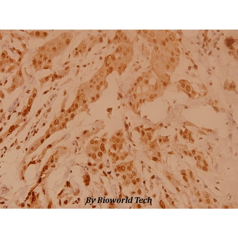 Anti-Nucleophosmin (E22) Antibody from Bioworld Technology (BS2353) - Antibodies.com