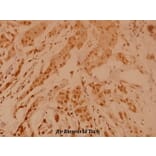 Anti-Nucleophosmin (E22) Antibody from Bioworld Technology (BS2353) - Antibodies.com