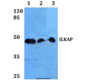 Anti-ILKAP (K71) Antibody from Bioworld Technology (BS2359) - Antibodies.com
