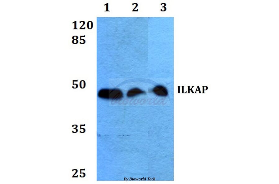 Anti-ILKAP (K71) Antibody from Bioworld Technology (BS2359) - Antibodies.com