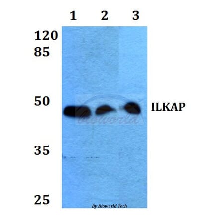 Anti-ILKAP (K71) Antibody from Bioworld Technology (BS2359) - Antibodies.com