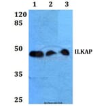 Anti-ILKAP (K71) Antibody from Bioworld Technology (BS2359) - Antibodies.com