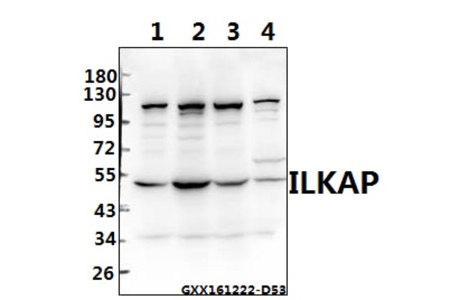 Anti-ILKAP (K71) Antibody from Bioworld Technology (BS2359) - Antibodies.com
