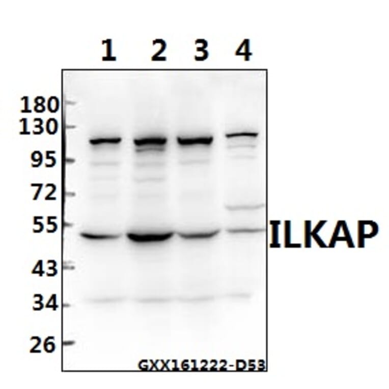 Anti-ILKAP (K71) Antibody from Bioworld Technology (BS2359) - Antibodies.com