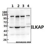 Anti-ILKAP (K71) Antibody from Bioworld Technology (BS2359) - Antibodies.com