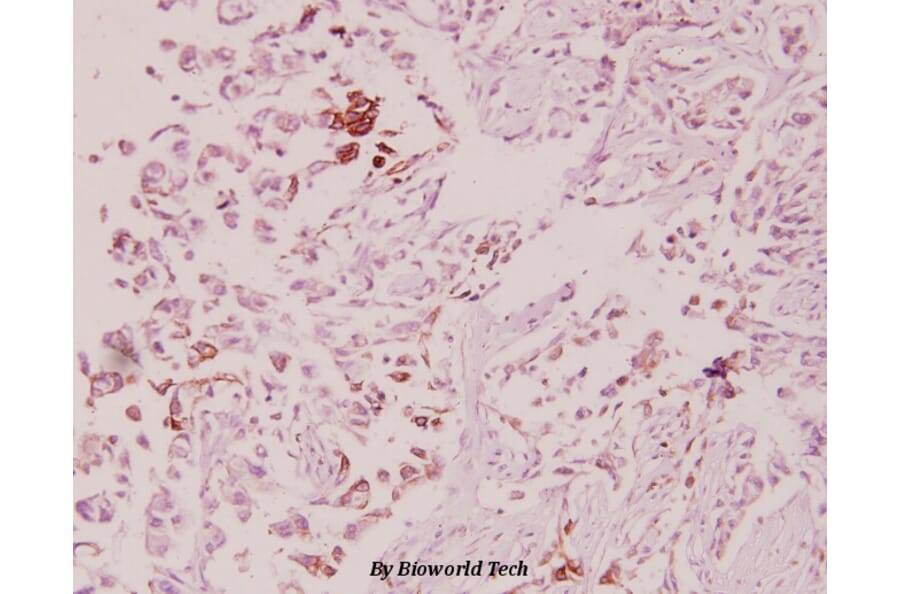 Anti-ILKAP (K71) Antibody from Bioworld Technology (BS2359) - Antibodies.com