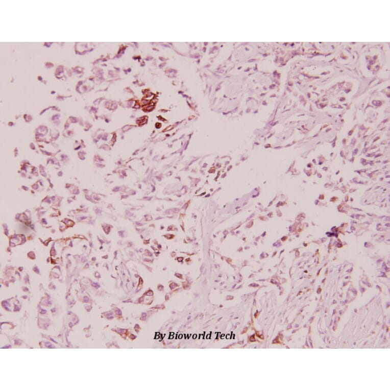 Anti-ILKAP (K71) Antibody from Bioworld Technology (BS2359) - Antibodies.com
