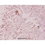 Anti-ILKAP (K71) Antibody from Bioworld Technology (BS2359) - Antibodies.com