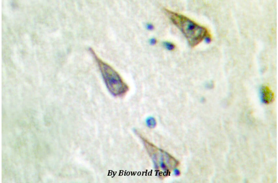 Anti-SEMA4A (N532) Antibody from Bioworld Technology (BS2363) - Antibodies.com