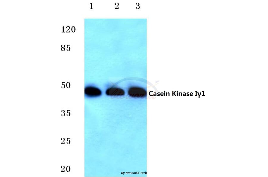Anti-Casein Kinase Iγ1 (H3) Antibody from Bioworld Technology (BS2366) - Antibodies.com