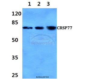 Anti-CRSP77 (V171) Antibody from Bioworld Technology (BS2368) - Antibodies.com
