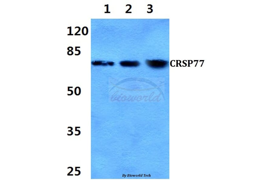 Anti-CRSP77 (V171) Antibody from Bioworld Technology (BS2368) - Antibodies.com