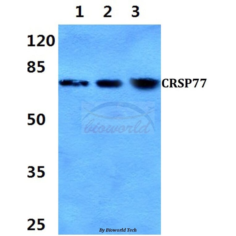 Anti-CRSP77 (V171) Antibody from Bioworld Technology (BS2368) - Antibodies.com