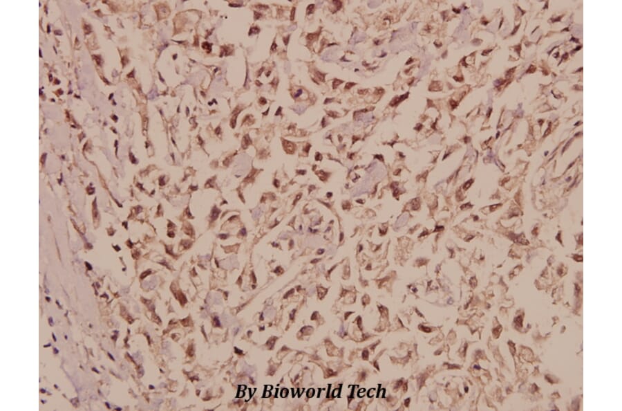 Anti-CRSP77 (V171) Antibody from Bioworld Technology (BS2368) - Antibodies.com