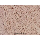 Anti-CRSP77 (V171) Antibody from Bioworld Technology (BS2368) - Antibodies.com