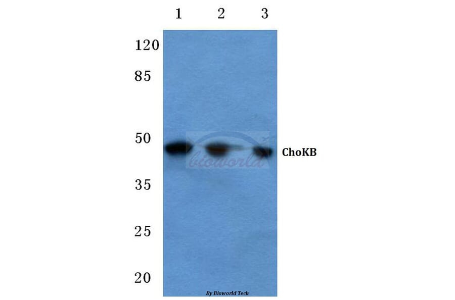 Anti-ChoKB (E324) Antibody from Bioworld Technology (BS2377) - Antibodies.com