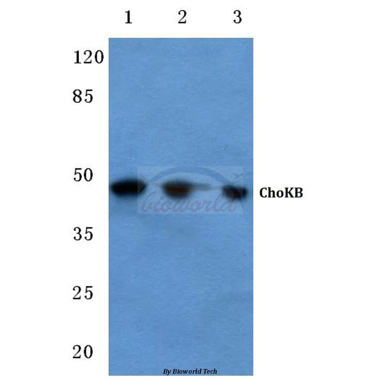 Anti-ChoKB (E324) Antibody from Bioworld Technology (BS2377) - Antibodies.com