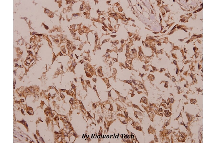 Anti-ChoKB (E324) Antibody from Bioworld Technology (BS2377) - Antibodies.com
