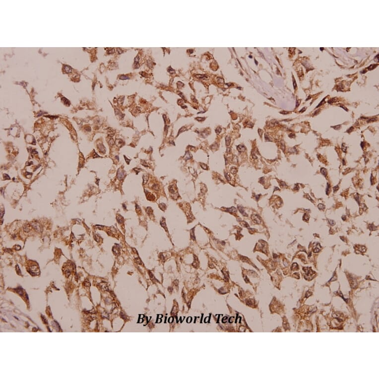 Anti-ChoKB (E324) Antibody from Bioworld Technology (BS2377) - Antibodies.com