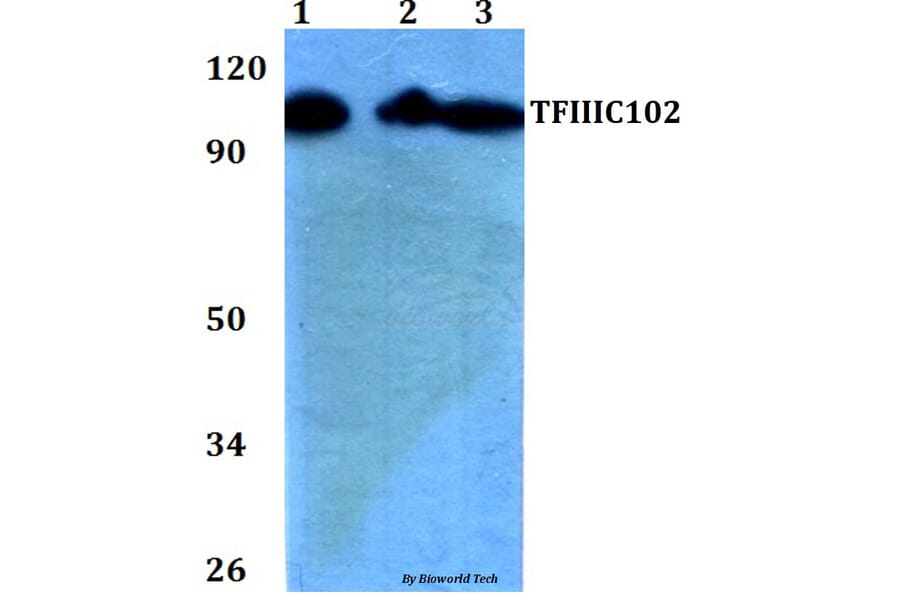 Anti-TFIIIC102 (E131) Antibody from Bioworld Technology (BS2381) - Antibodies.com