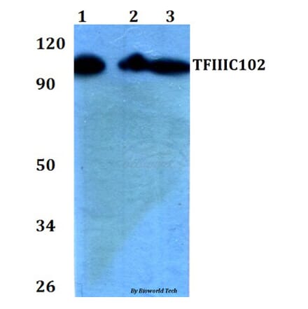 Anti-TFIIIC102 (E131) Antibody from Bioworld Technology (BS2381) - Antibodies.com