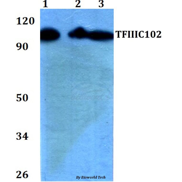 Anti-TFIIIC102 (E131) Antibody from Bioworld Technology (BS2381) - Antibodies.com