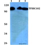 Anti-TFIIIC102 (E131) Antibody from Bioworld Technology (BS2381) - Antibodies.com