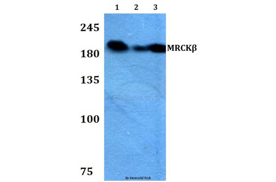 Anti-MRCKβ (F1665) Antibody from Bioworld Technology (BS2382) - Antibodies.com