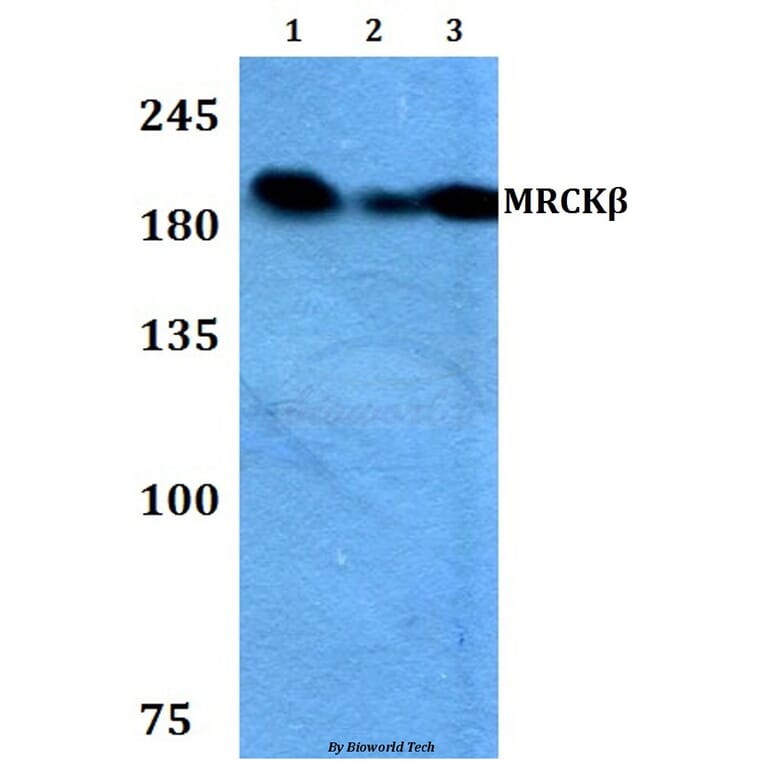 Anti-MRCKβ (F1665) Antibody from Bioworld Technology (BS2382) - Antibodies.com