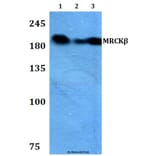 Anti-MRCKβ (F1665) Antibody from Bioworld Technology (BS2382) - Antibodies.com