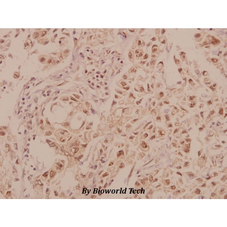 Anti-MRCKβ (F1665) Antibody from Bioworld Technology (BS2382) - Antibodies.com