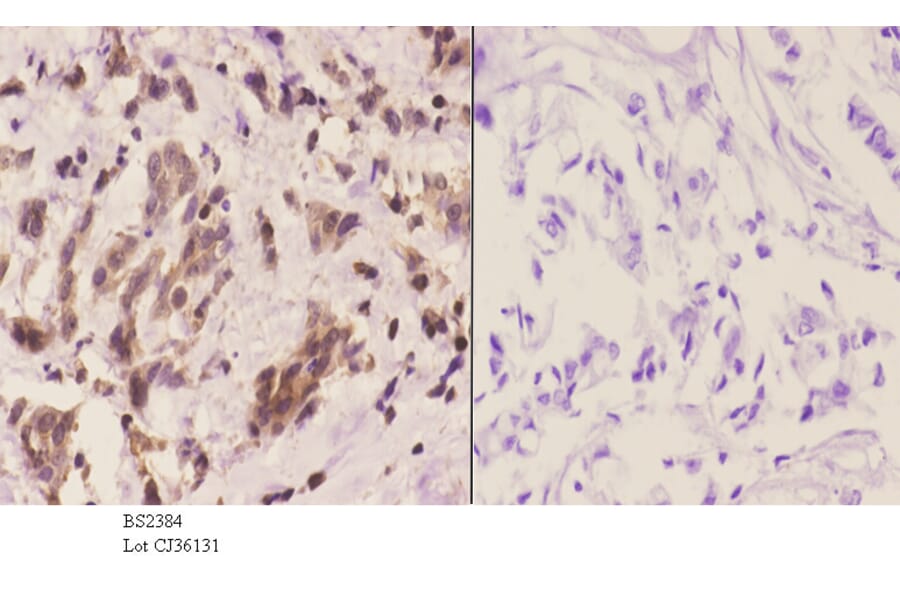 Anti-14-3-3 η (K81) Antibody from Bioworld Technology (BS2384) - Antibodies.com