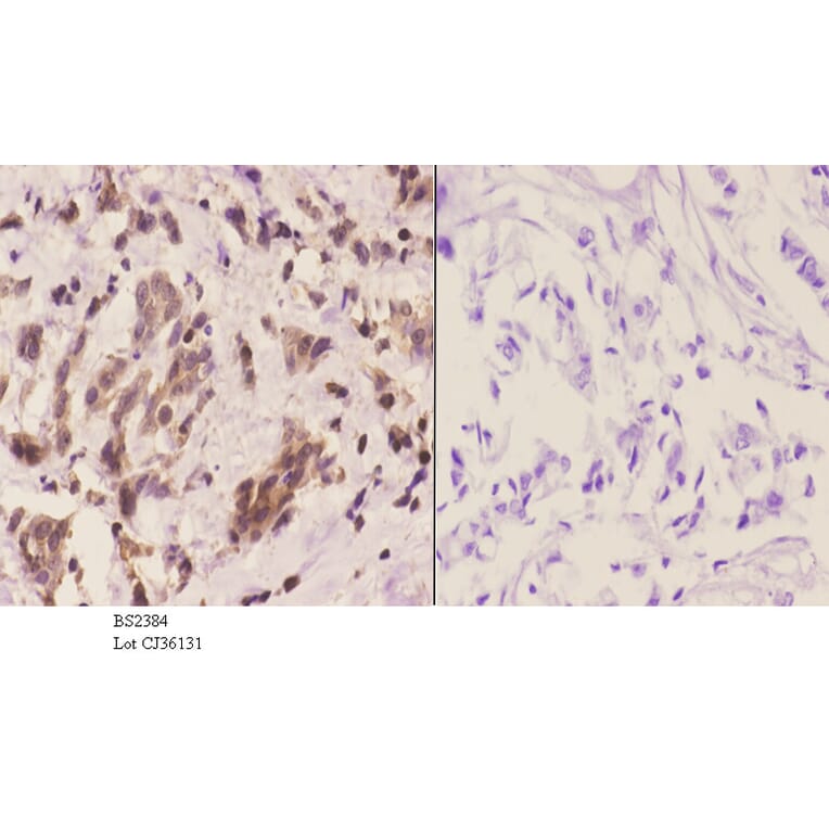 Anti-14-3-3 η (K81) Antibody from Bioworld Technology (BS2384) - Antibodies.com