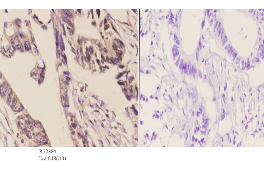 Anti-14-3-3 η (K81) Antibody from Bioworld Technology (BS2384) - Antibodies.com