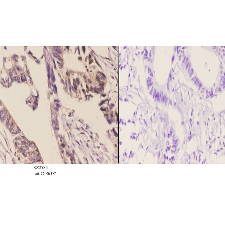 Anti-14-3-3 η (K81) Antibody from Bioworld Technology (BS2384) - Antibodies.com