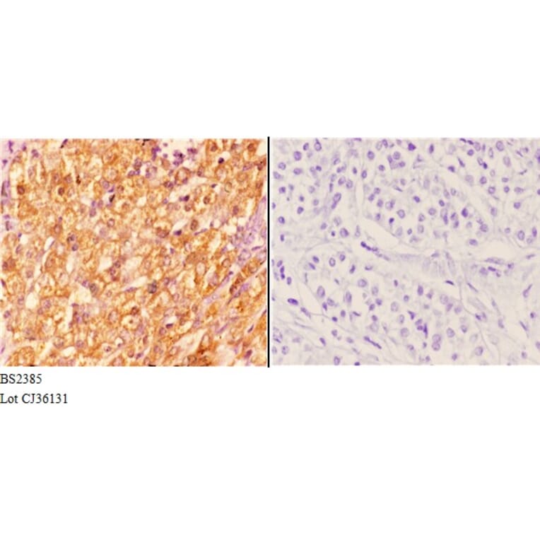 Anti-14-3-3 ζ (A79) Antibody from Bioworld Technology (BS2385) - Antibodies.com